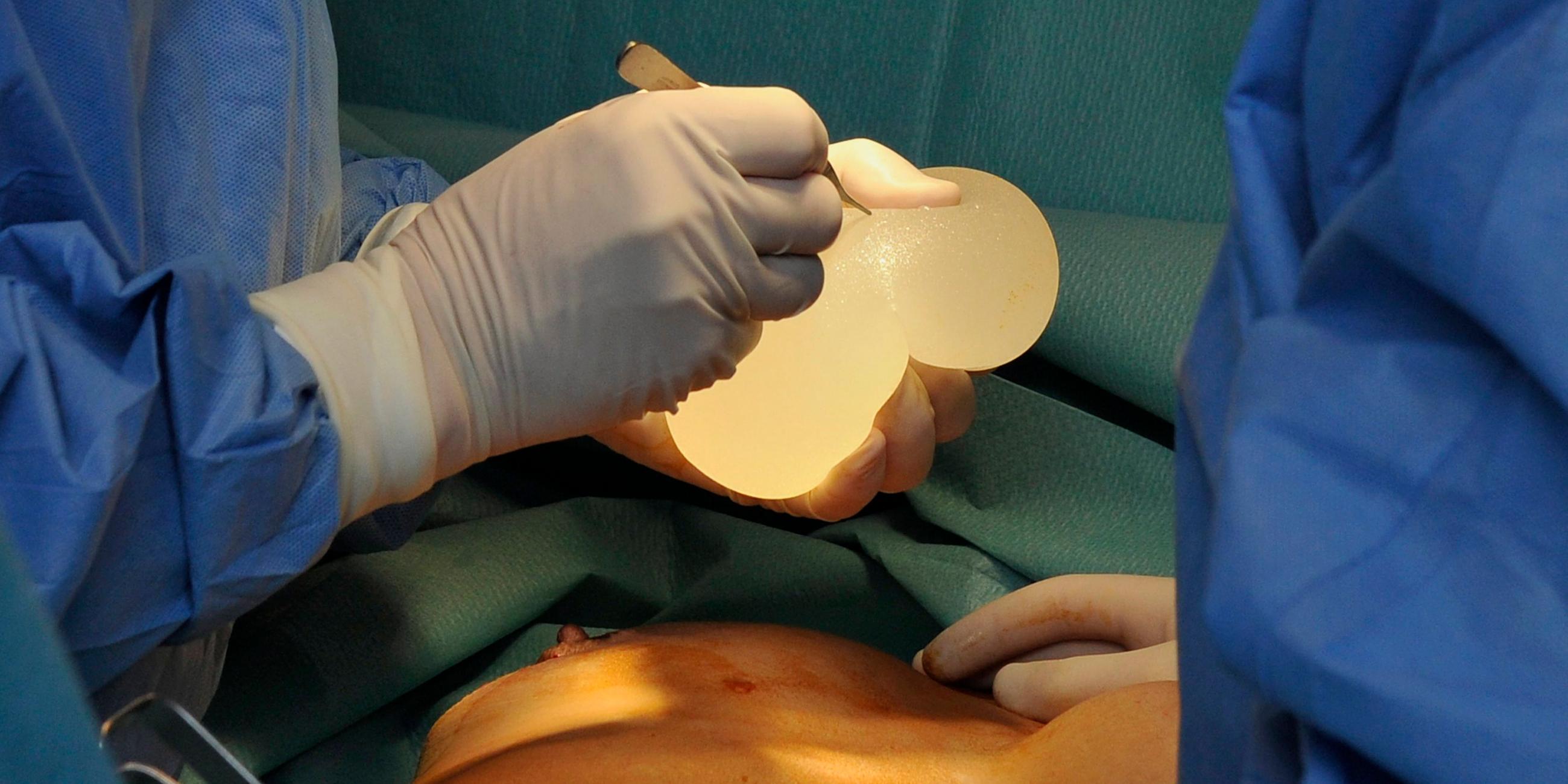 Archiv: Der französische plastische Chirurg Denis Boucq (l.) entfernt defekte Silikongel-Brustimplantate des französischen Unternehmens Poly Implant Prothese (PIP) in der Mozart-Klinik in Nizza, Südfrankreich, 12. 01. 2012. 