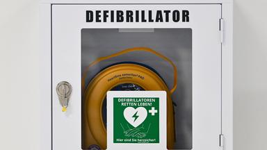 Ein Defibrillator hängt an einer Wand.