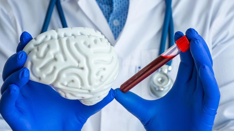 Ein Mann im Arztkittel hält ein Modell von einem Gehirn und Blutröhrchen in der Hand.