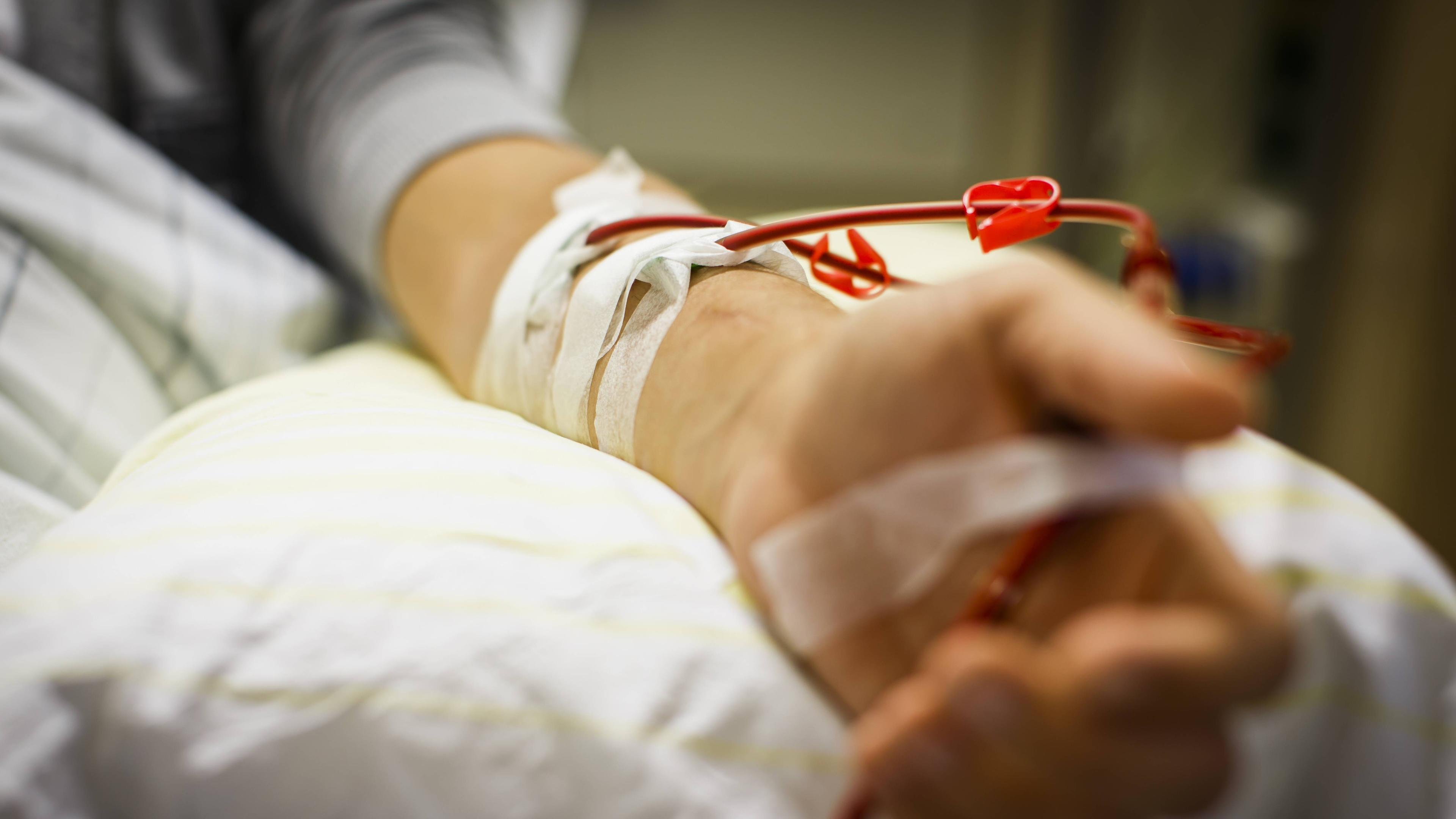 Hand eines Patienten während der Dialyse