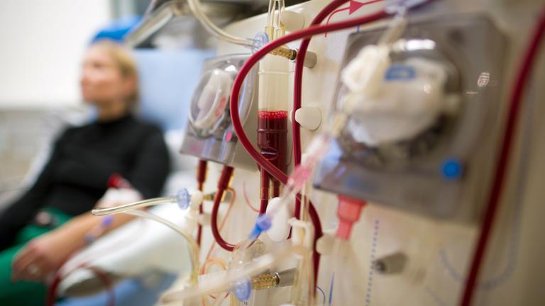 Eine blonde Frau sitzt auf einem Stuhl und erhält eine Dialyse.