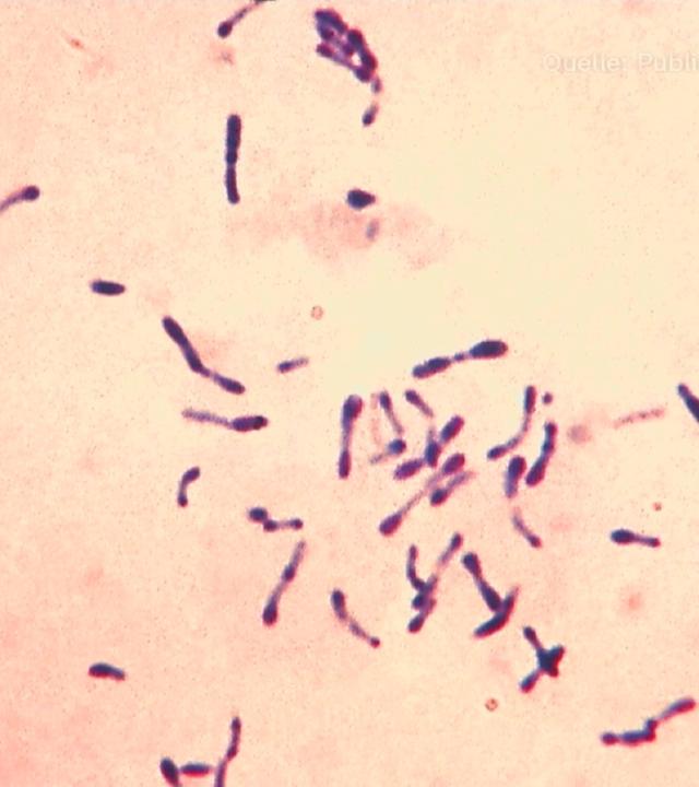 Diphtherie-Bakterien unter dem Mikroskop.