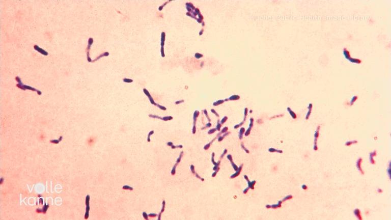 Diphtherie-Bakterien unter dem Mikroskop.