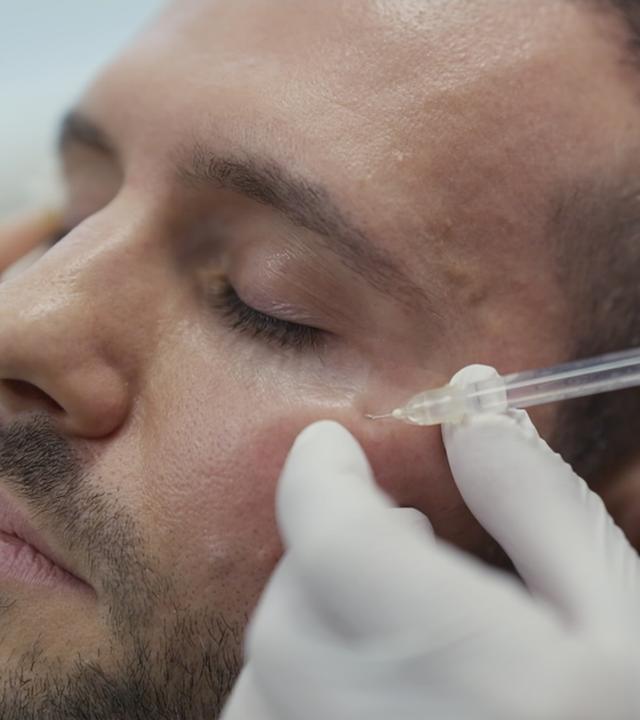 Einem Mann wird eine Flüssigkeit ins Gesicht gespritzt.