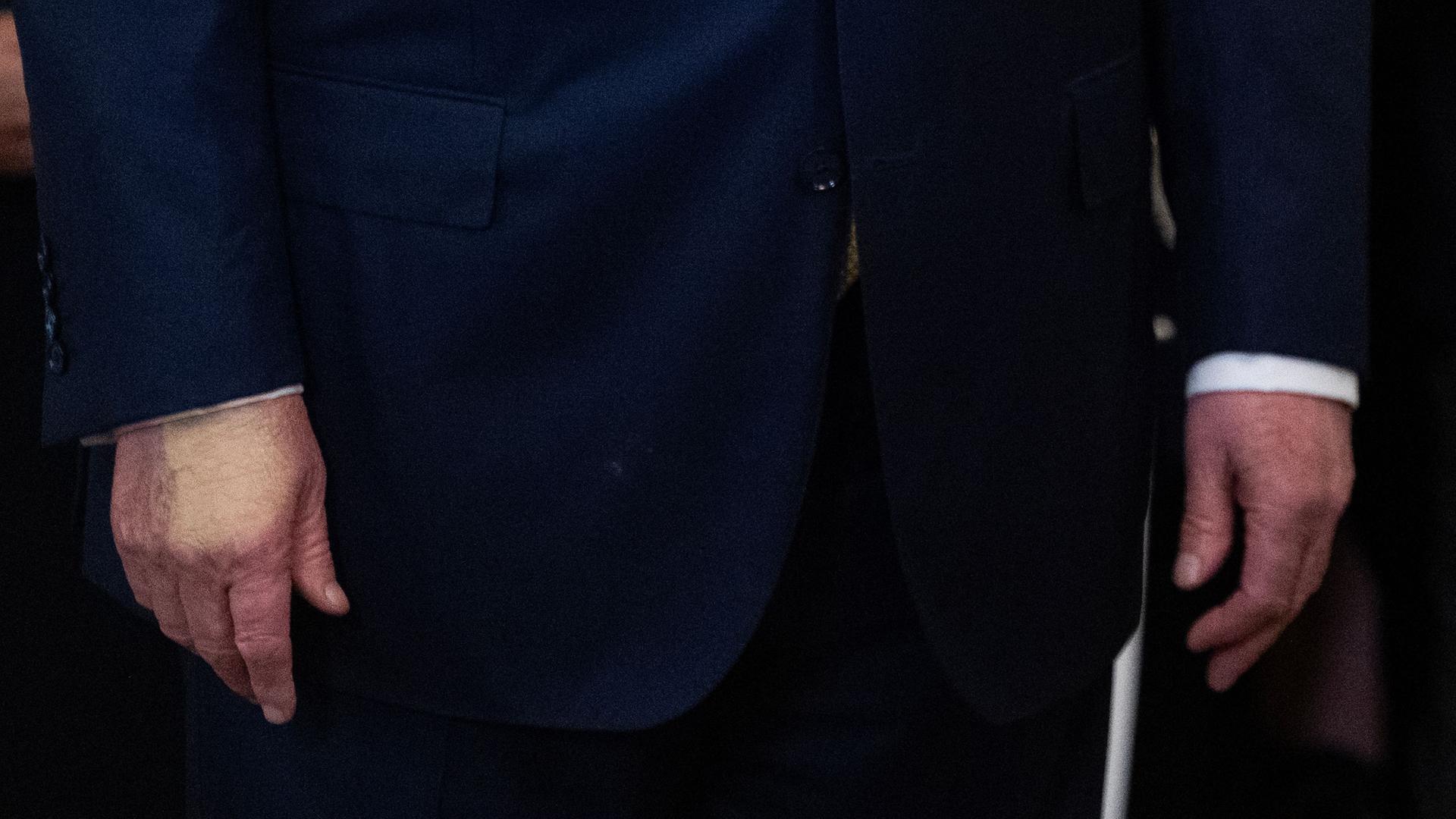 Eine Verfärbung ist auf der Hand von US-Präsident Donald Trump zu sehen