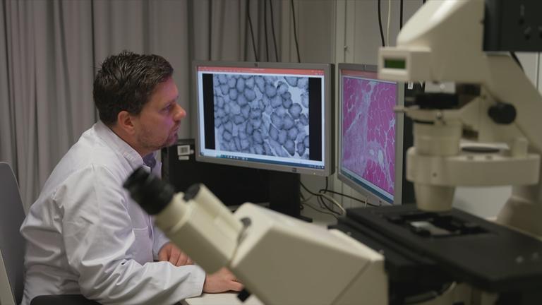 Durchbruch in der Forschung zu Long Covid