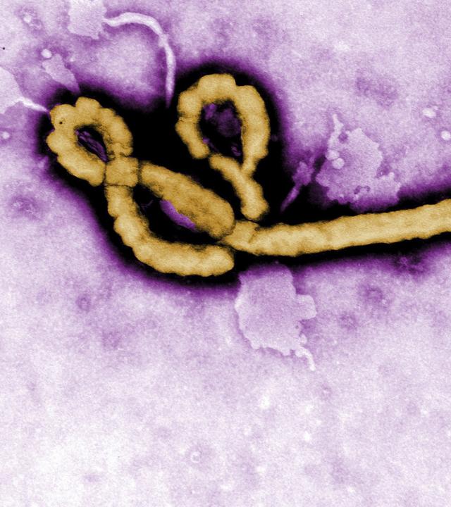 Das Ebola-Virus 
