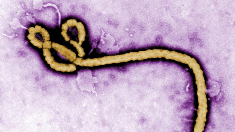 Das Ebola-Virus 