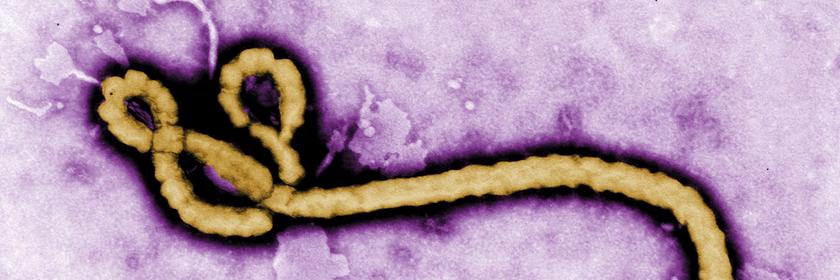 Das Ebola-Virus 