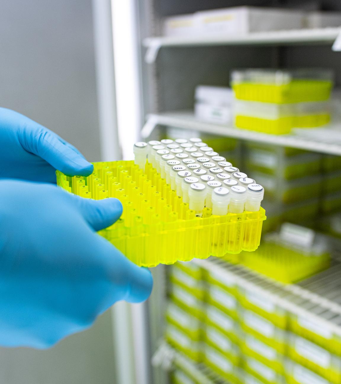 22.04.2021, Nordrhein-Westfalen, Münster: Prof. Alexander Mellmann, EHEC-Experte, Facharzt für Mikrobiologe und Hygiene am Universitätsklinikum Münster, zieht Proben verschiedener Keime, aus einem Kühlschrank.