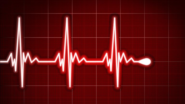 Der Herzrhythmus durch eine Elektrokardiografie (EKG) aufgenommen.