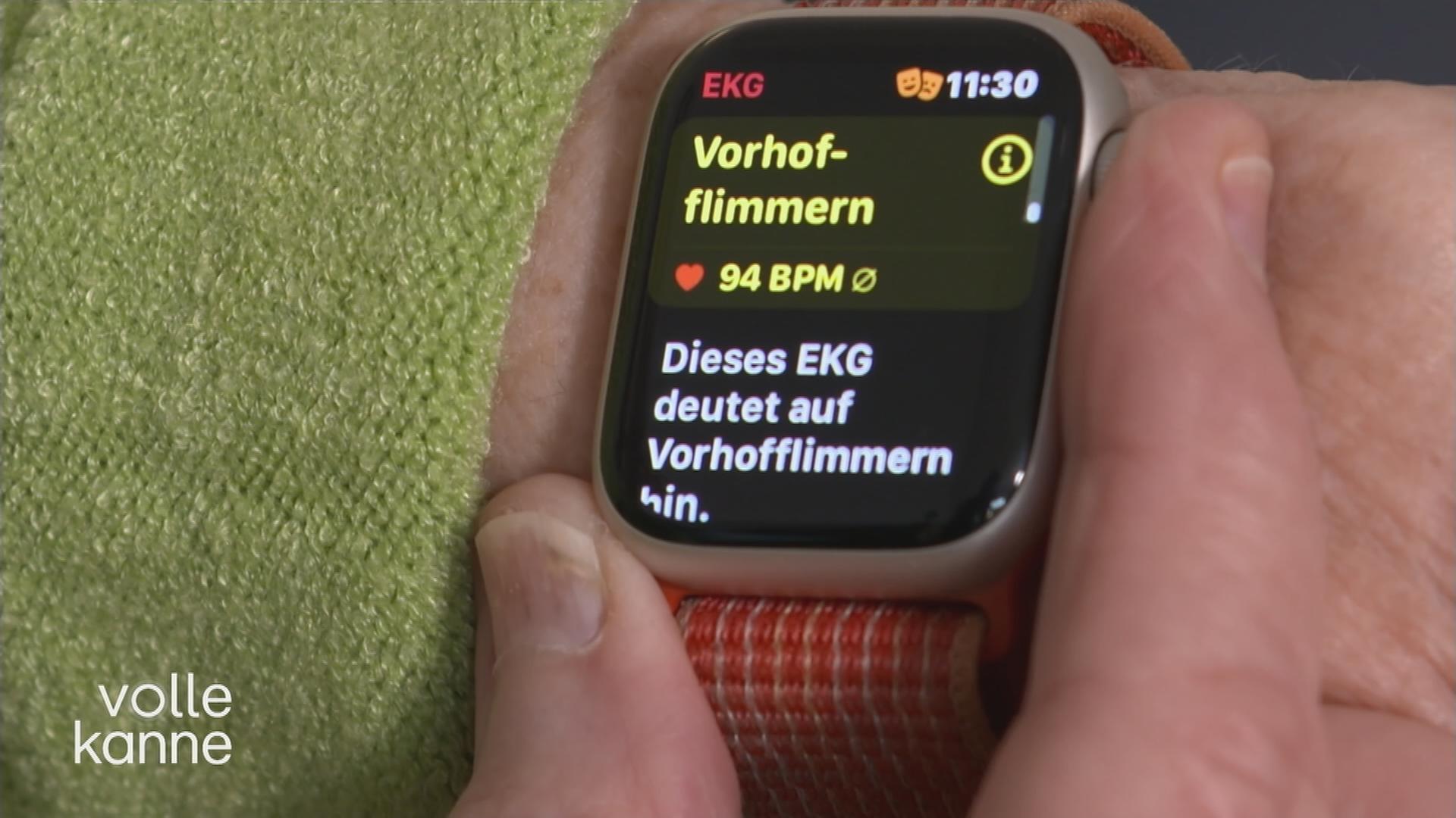 EKG-Messung mit Smartwatches