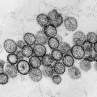 Drei Tote auf Kreuzfahrtschiff „Hondius“: Hantavirus-Verdacht – deutscher Passagier gestorben — image 6