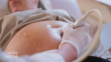 Endometriose nach Kaiserschnitt