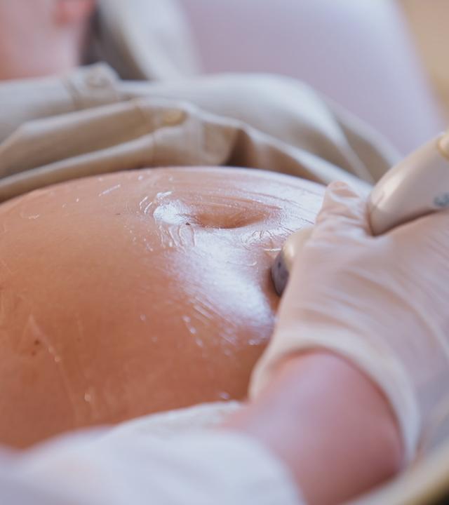 Endometriose nach Kaiserschnitt