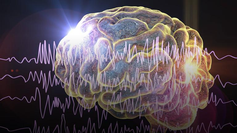 Illustration von Nervenzellenimpulsen und einer schematischen Darstellung eines Gehirns