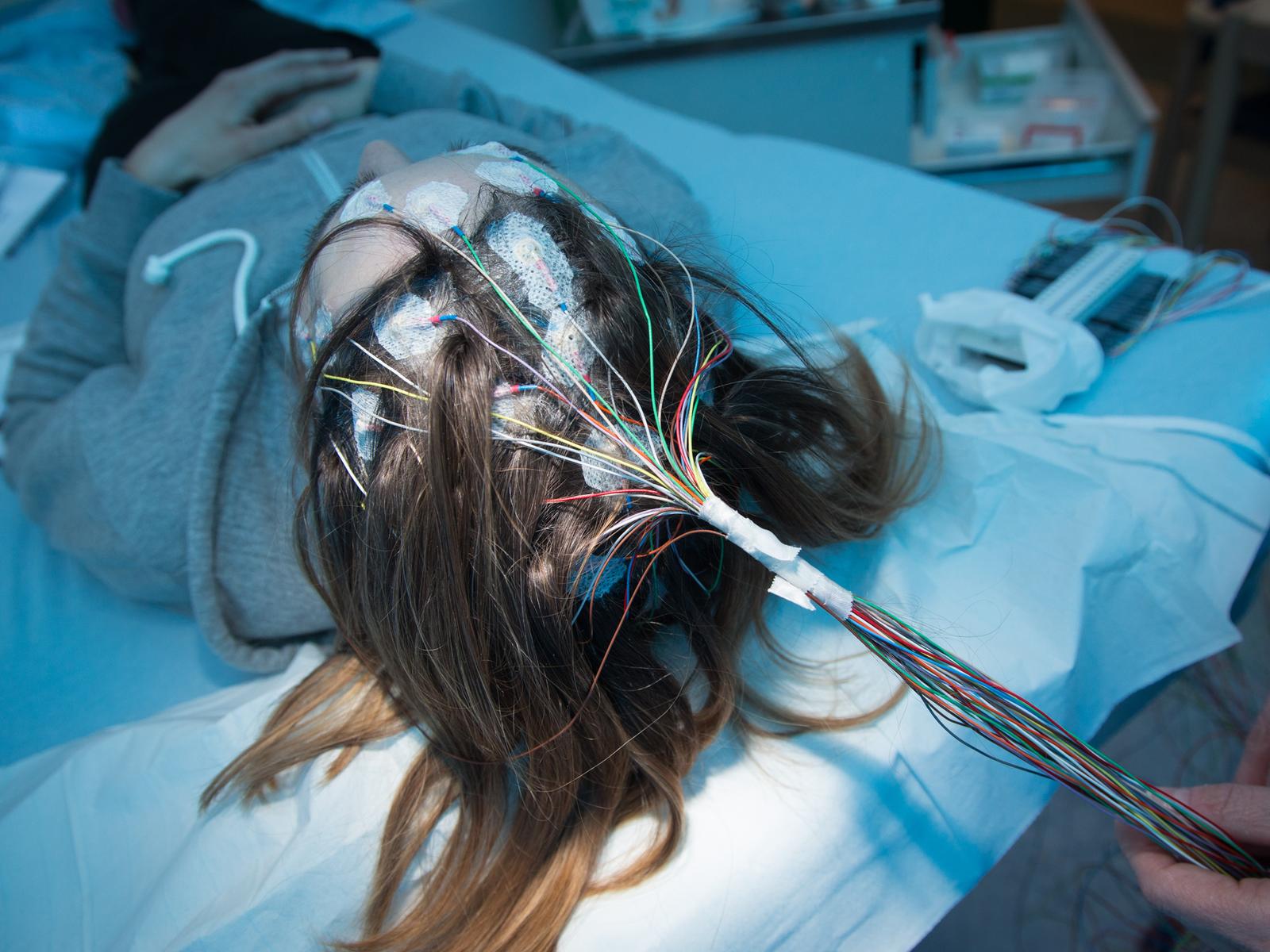 Wie ein epileptischer Anfall entsteht und behandelt wird