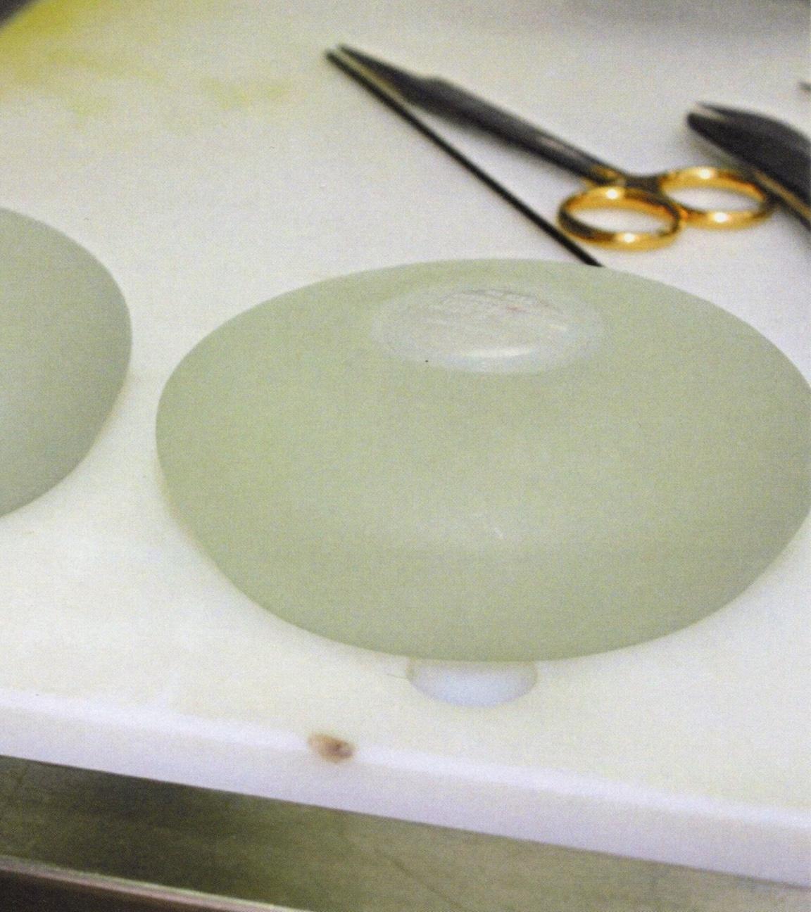 Zwei weiße, ovale Silikonkissen liegen auf einem weißen Marmortisch. Oberhalb des rechten Implantats liegt eine Operationsklammer.