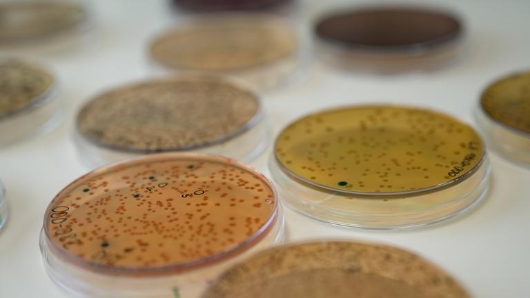Mehrere Petrischalen mit Mikroorganismen stehen auf einem hellen Untergrund.