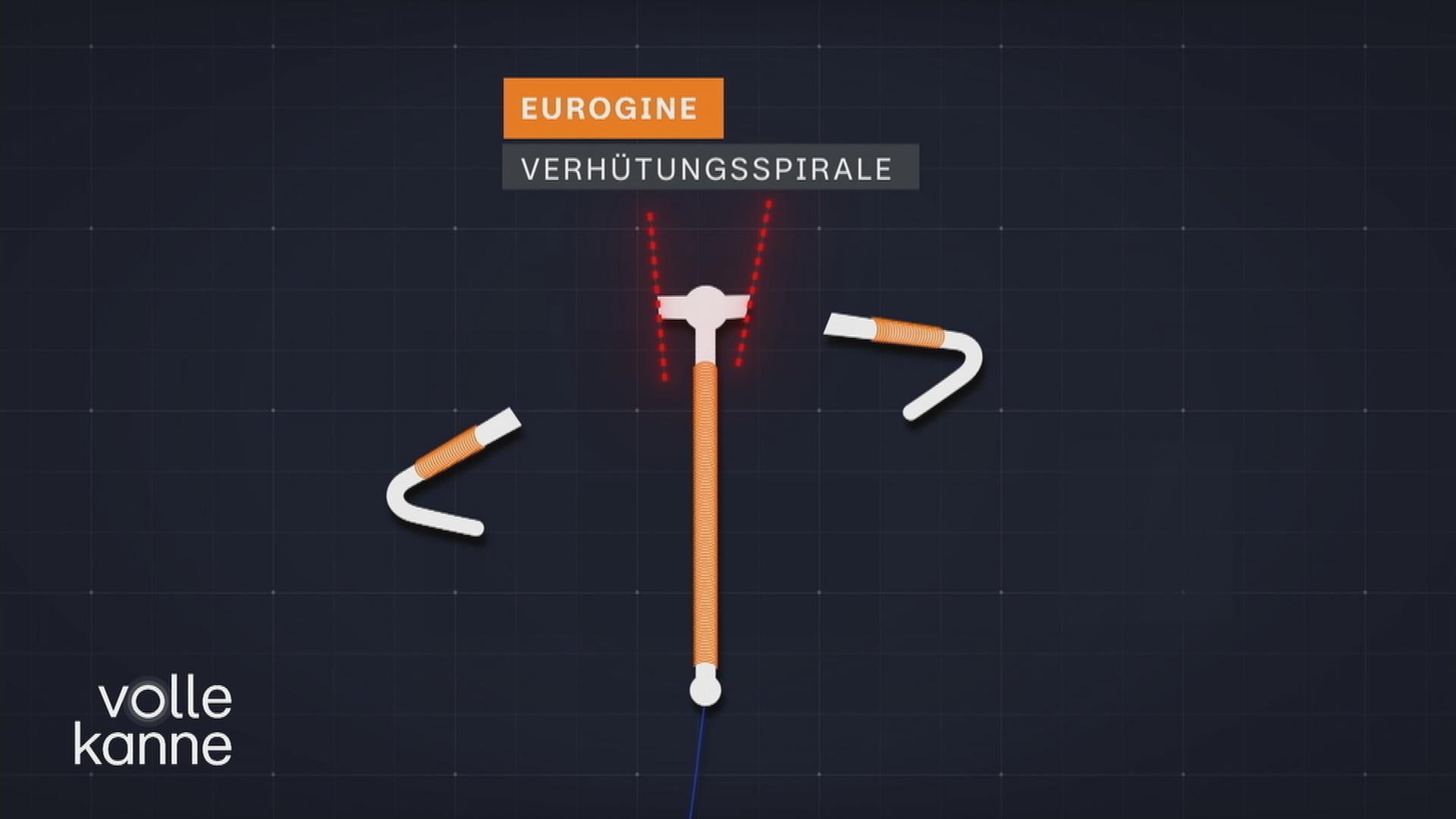 Fehlerhafte Spiralen