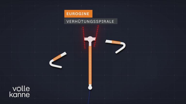Fehlerhafte Spiralen
