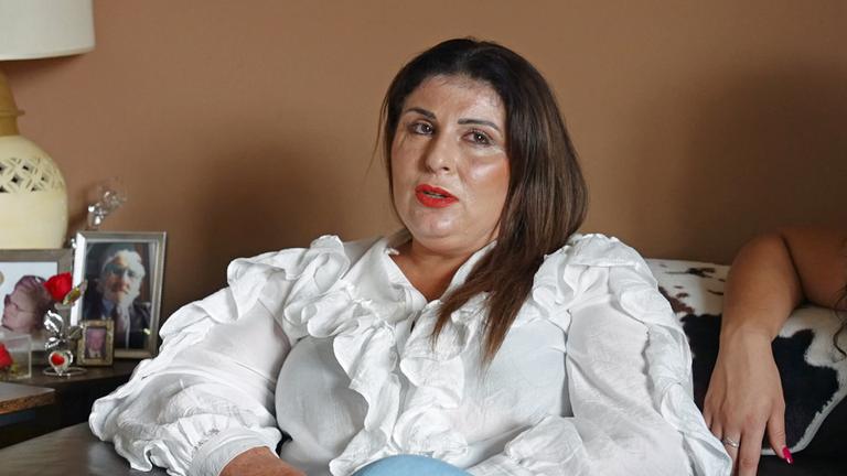 Die Italienerin Maria Antonietta Rositani spricht über den Brandanschlag, den ihr Mann aus Eifersucht auf sie verübte.