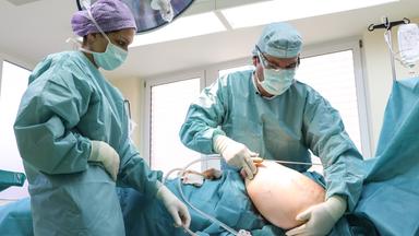 Patientin leigt auf OP-Tisch und eine OP-Schwester und ein Arzt bereiten die Fettabsaugung am Oberarm vor.