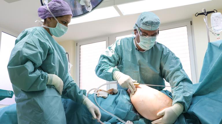 Patientin leigt auf OP-Tisch und eine OP-Schwester und ein Arzt bereiten die Fettabsaugung am Oberarm vor.