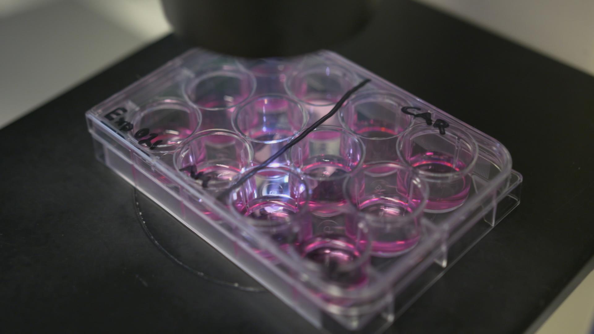 Ein Forschungsteam in Heidelberg arbeitet an einer Therapie zur Behandlung von Blutkrebs. 