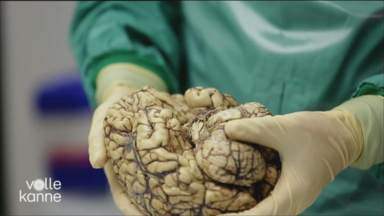 Arzt hat ein Modell eines Gehirns in der Hand