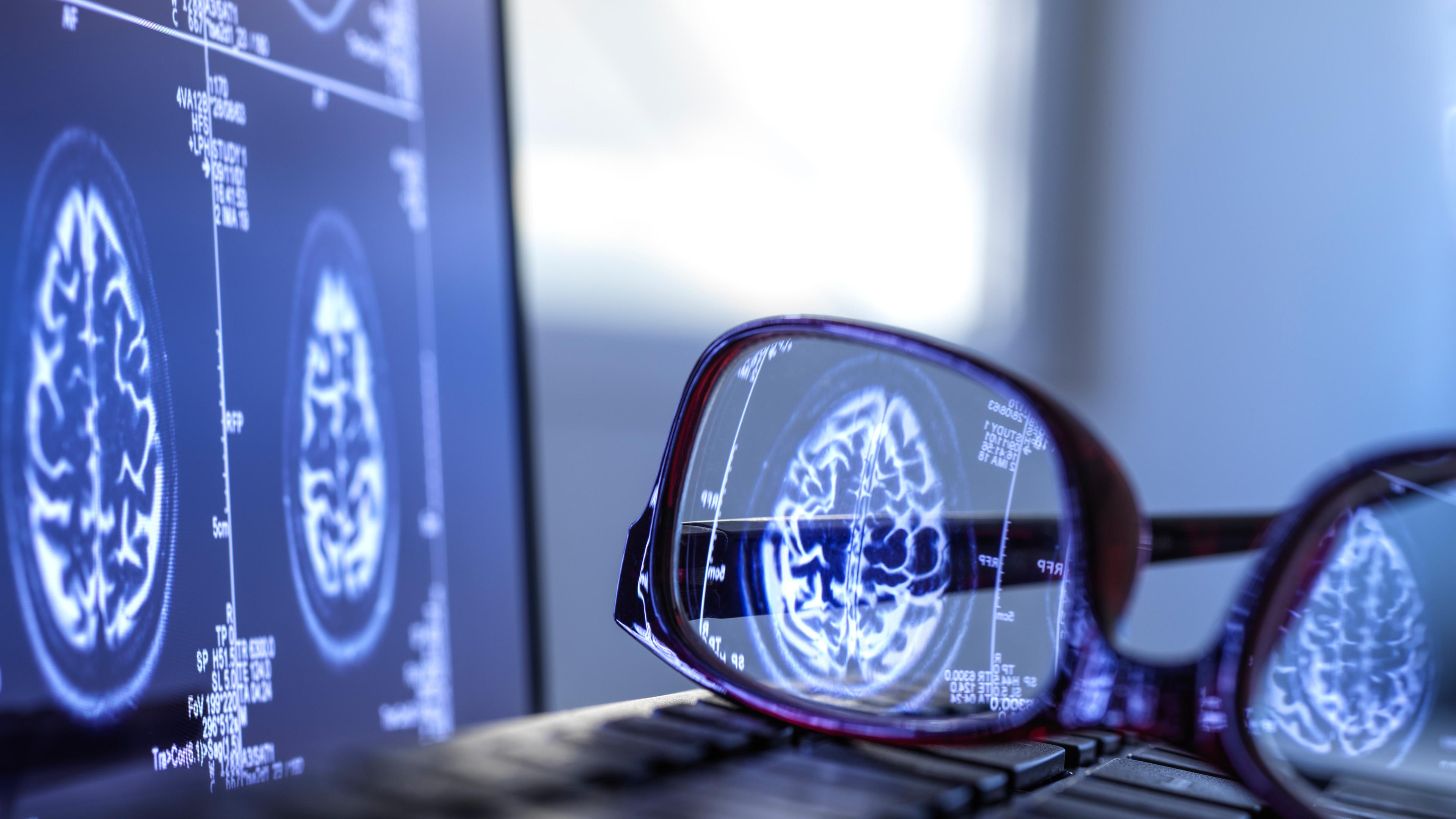 Gehirnscan auf Computer spiegelt sich in Brille