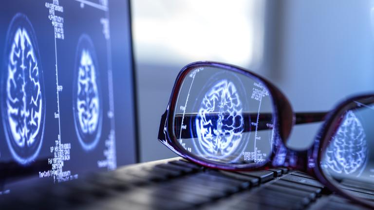 Gehirnscan auf Computer spiegelt sich in Brille