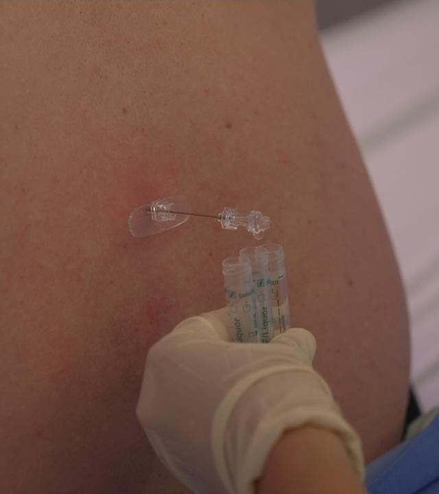 Einführung eines medizinischen Geräts in den Rücken eines Patienten