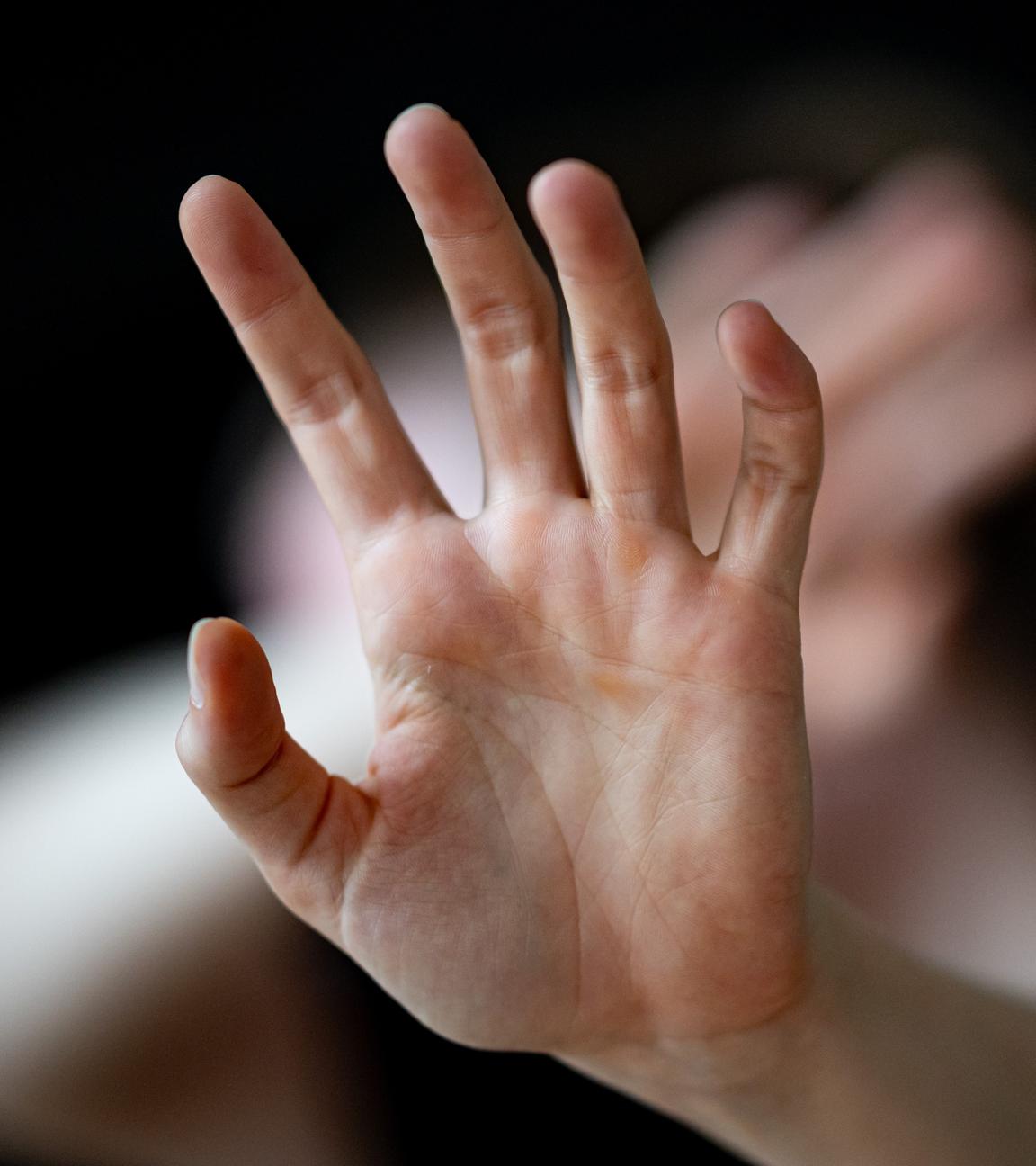  Eine Frau hält ihre Hände vor das Gesicht. (Gestellte Szene)