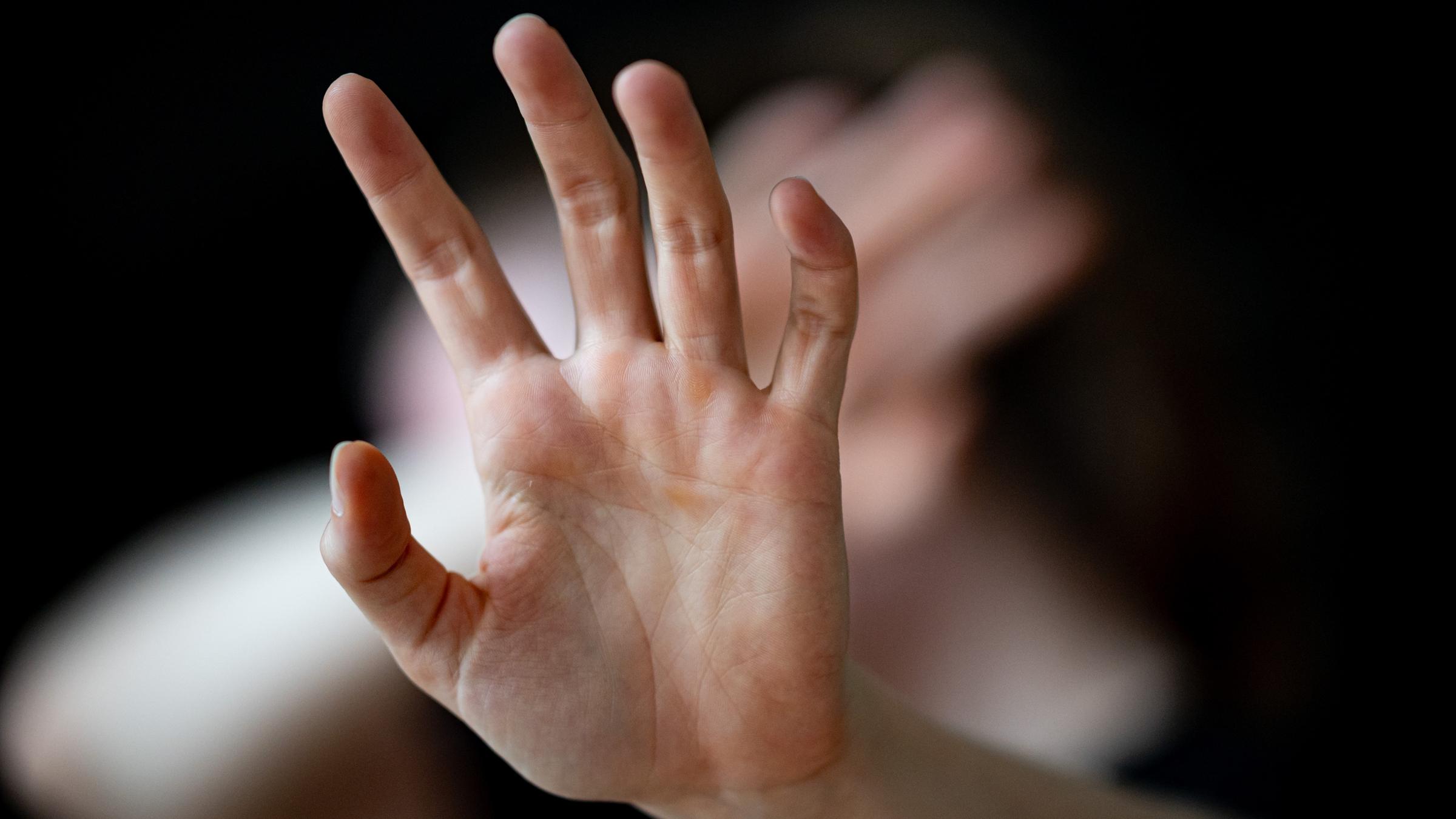  Eine Frau hält ihre Hände vor das Gesicht. (Gestellte Szene)