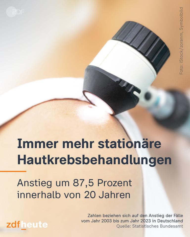 Grafik: Immer mehr stationäre Hautkrebsbehandlungen