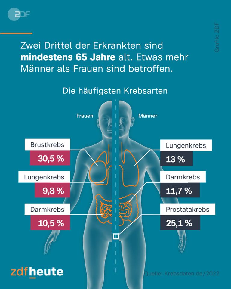 Grafik: Die häufigsten Krebsarten
