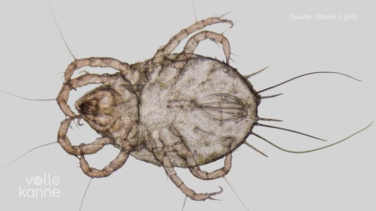 Eine mikroskopische Aufnahme einer Milbe