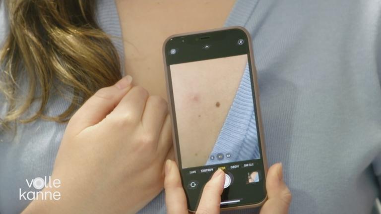 Handy macht ein Foto von einem Muttermal