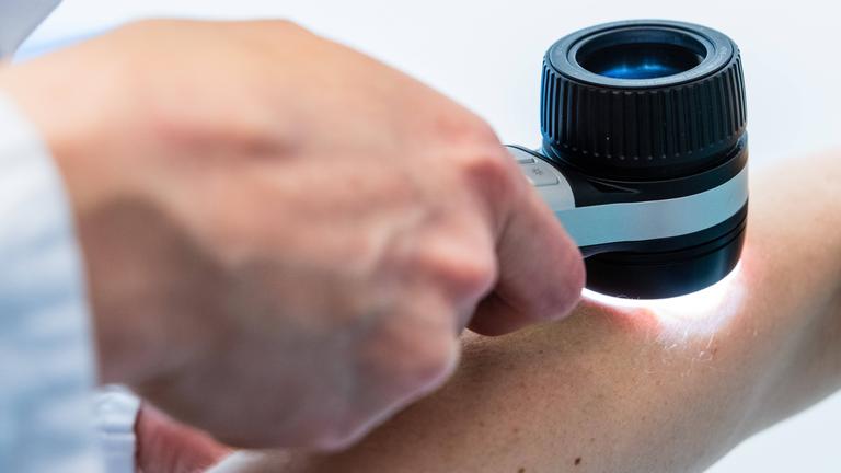 Untersuchung eines Unterams mit einem Dermatoskop, einem Auflicht-Mikroskop, durch einen Hautarzt.