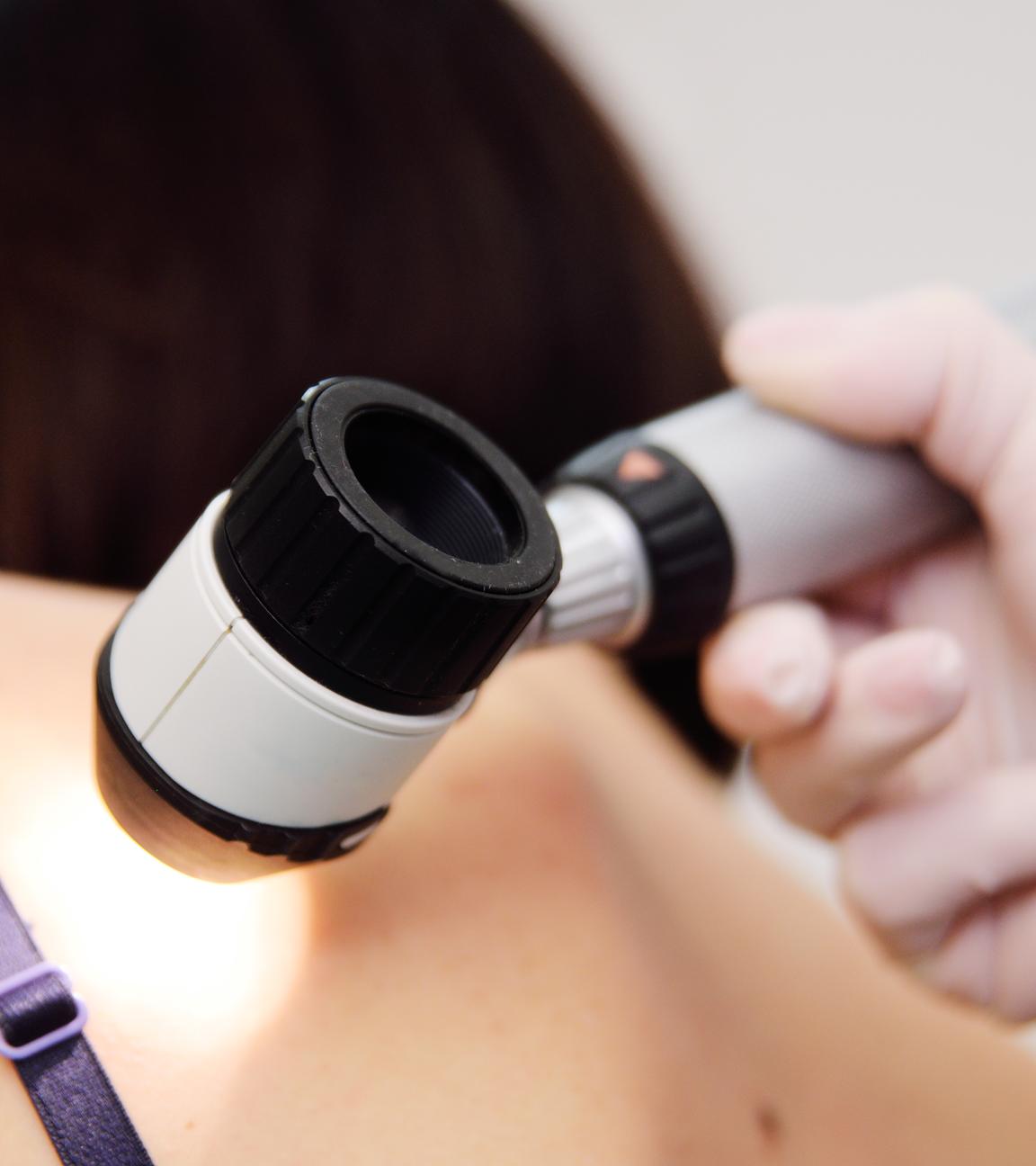 Ein Arzt untersucht Muttermale bei einer Patientin.