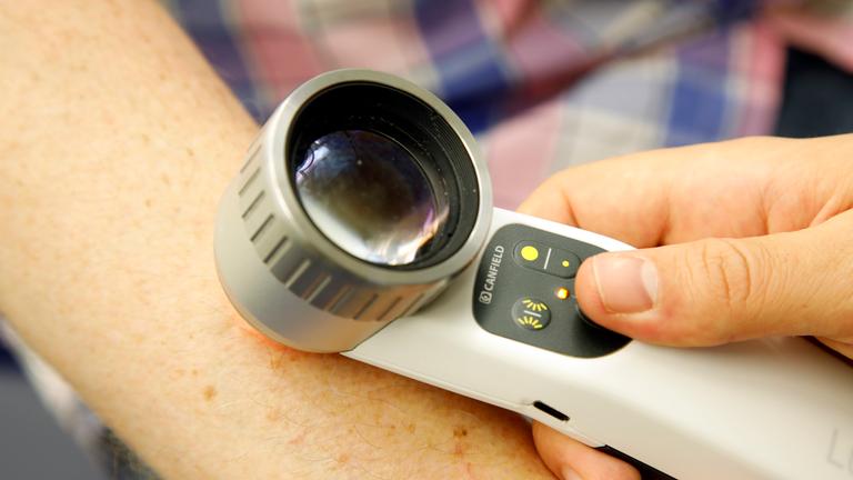 Ein männlicher Patient unterzieht sich einem Hautscreening.