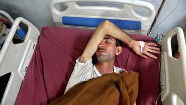 Ein Patient mit Hepatitis wird am Internationalen Hepatitis-Tag im Lady Reading Government Hospital in Peshawar, Pakistan, medizinisch behandelt.