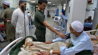 Ein Patient mit Hepatitis wird am Internationalen Hepatitis-Tag im Lady Reading Government Hospital in Peshawar, Pakistan, medizinisch behandelt.