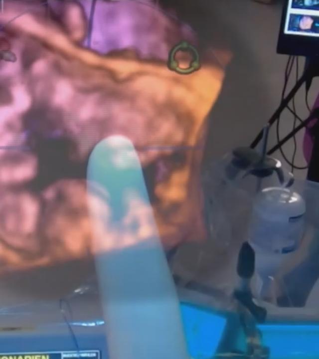 Ein Finger zeigt auf ein frei im Raum schwebendes 3D-Modell eines Herzens.