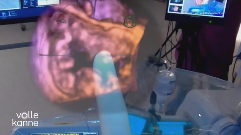 Ein Finger zeigt auf ein frei im Raum schwebendes 3D-Modell eines Herzens.