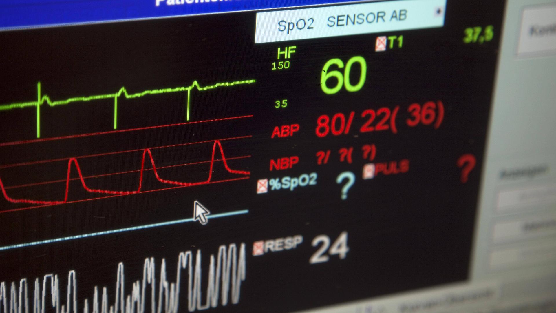 Herzfrequenzmessgerät