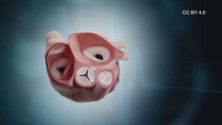 Herzklappen Funktion CC