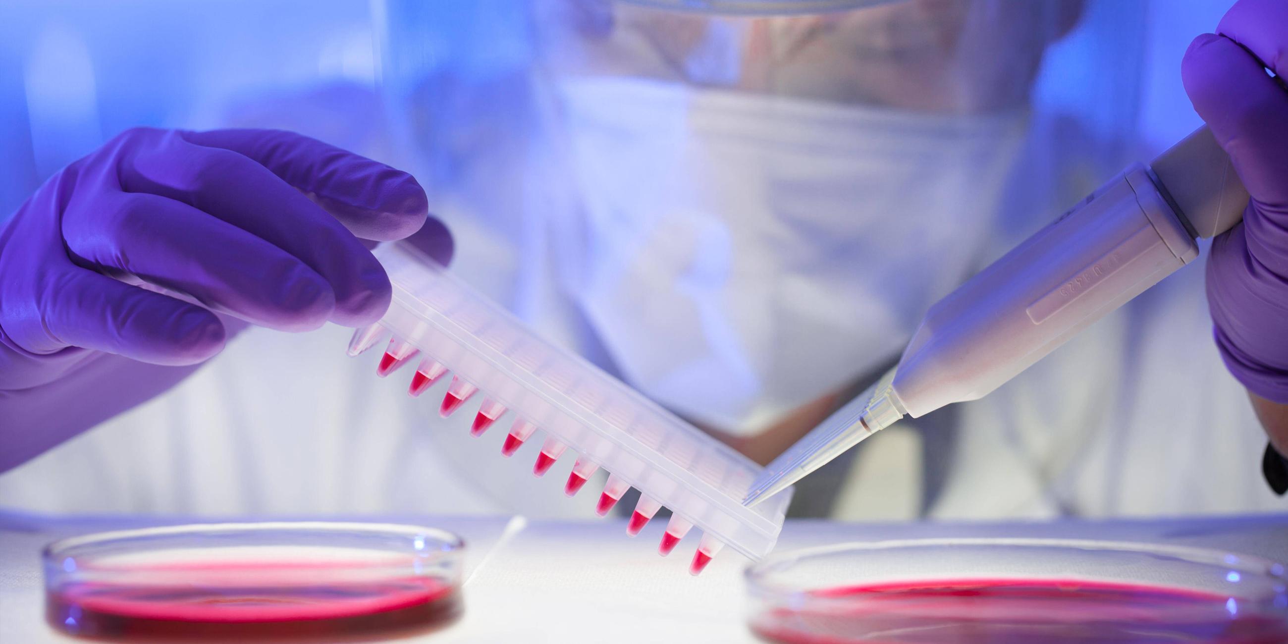 Humanserummedien mit HIV-infizierten Zellen werden von der Petrischale auf eine Mikrotiterplatte pipettiert. 