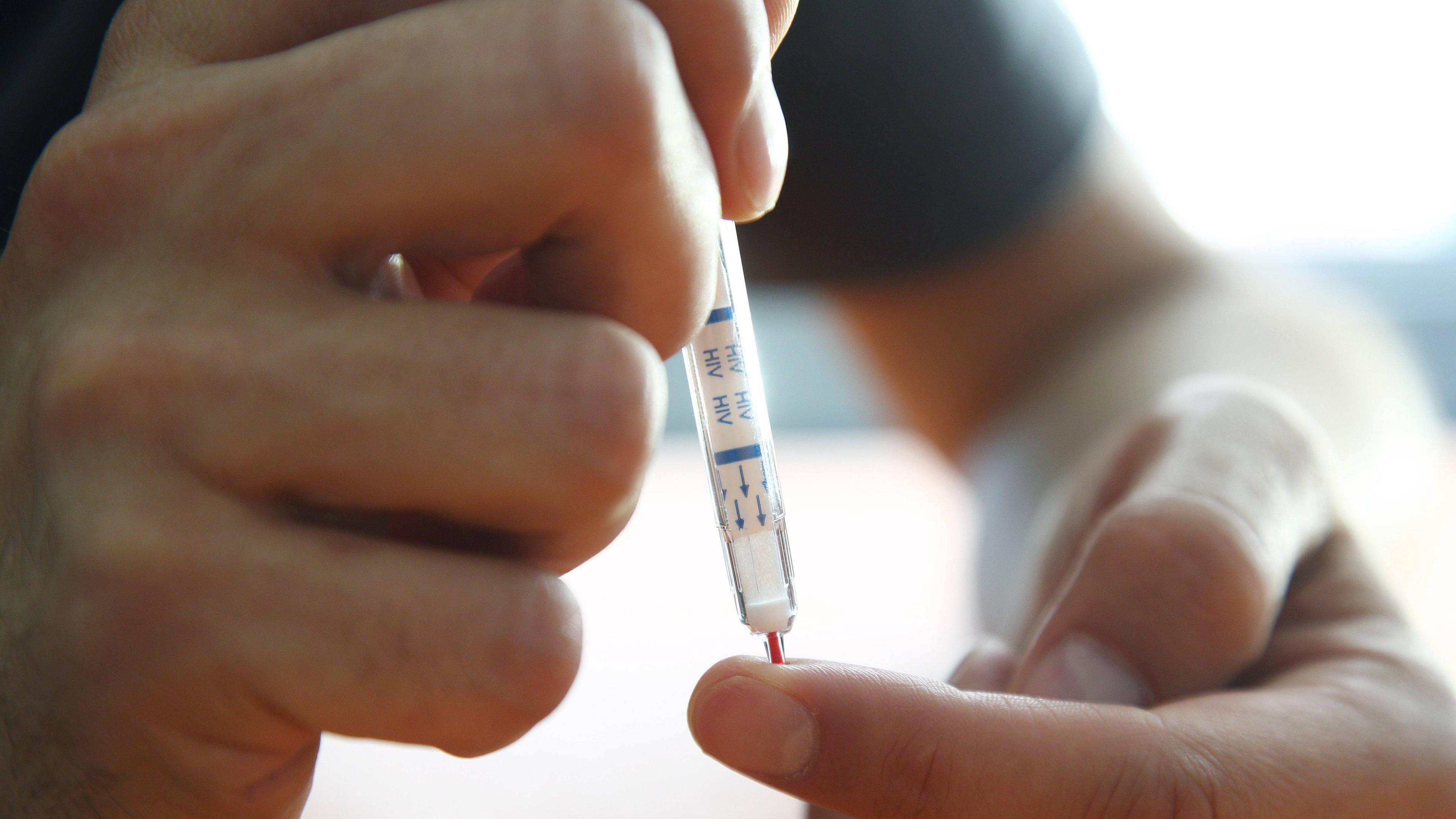 HIV-Selbsttest
